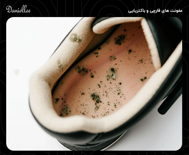عوارض پوشیدن کفش بدون جوراب؛ عوارضی که احتمالا نمی دانید!
